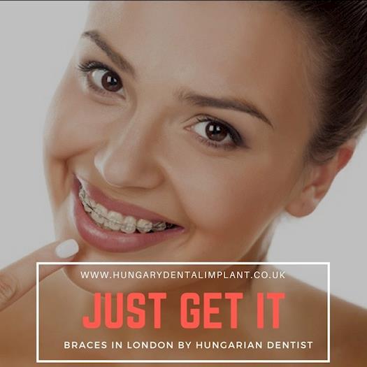 Just Get in Braces in London by Hungarian Dentist