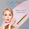 Best Micro Needling Pen