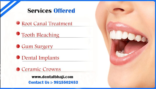 Best Dental Implants Hospital Mohali