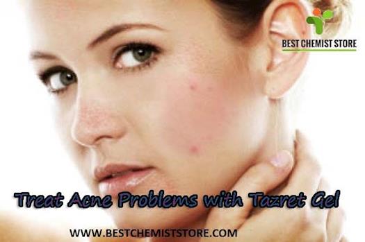 Treat Acne Problems with Tazret Gel
