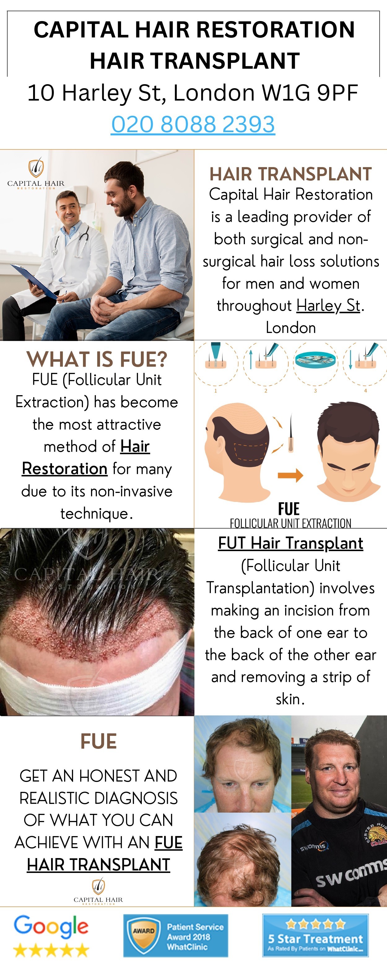 Hair Transplant in London, UK.  Here at Capital Hair Restoration, Harley Street Clinic 