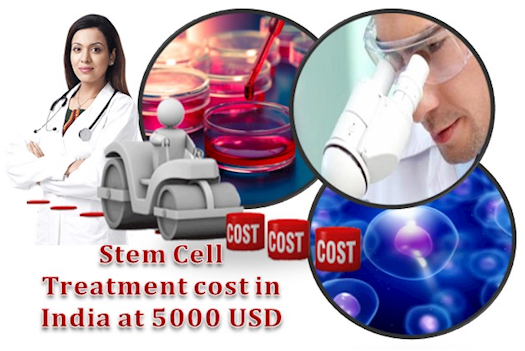 Stem Cell Treatment 
