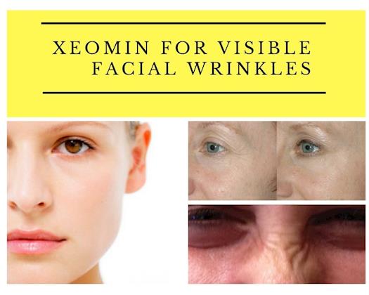 Xeomin Covering all Facial Wrinkles