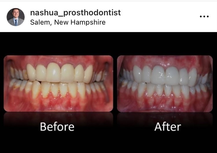 Prosthodontist Nashua NH