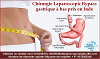 La chirurgie de dérivation gastrique laparoscopique à bas coût soutenue par la qualité résume les se