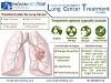 Consult the Best Oncologists for Your Lung Cancer Treatment in India