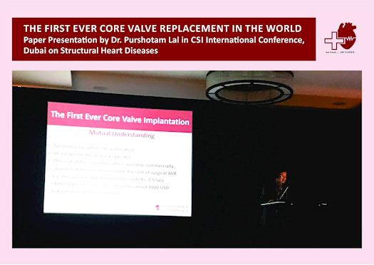 The First Ever Core Valve Replacement in the World; Paper Presentation by Dr. Purshotam Lal.