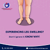Know why not to ignore leg swelling!
