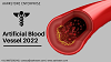 Global Artificial Blood Vessel Market | Share, Forecast 2022 