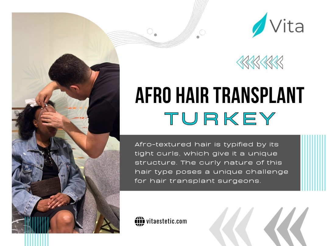 Afro Hair Transplant Turkey