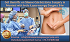 Get Benefits on Sleeve Gastrectomy Surgery in Mumbai with India Laparoscopy Surgery Site