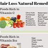 Hair Loss Natural Remedy
