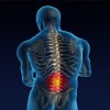 Chiropractic