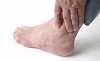 Various Safe and Effective Non-surgical Treatments for Gout