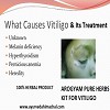 Cure Vitiligo or Leucoderma with AROGYAM PURE HERBS KIT FOR VITILIGO