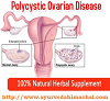 Arogyam Pure Herbs Kit For PCOS/PCOD For PCOS/PCOD