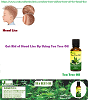 Tea Tree Oil for Head Lice - Natural Essential Oils - Natural Herbs Clinic
