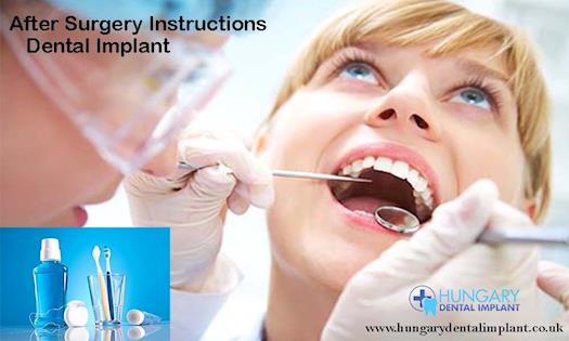 After Surgery Instructions Dental Implants