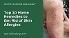 Top 10 Home Remedies to Get Rid of Skin Allergies