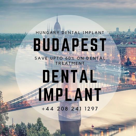 Save upto 60% on Dental Implant Treatment in Hungary (Budapest)