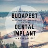 Save upto 60% on Dental Implant Treatment in Hungary (Budapest)