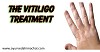 Cure Vitiligo with  AROGYAM PURE HERBS KIT FOR VITILIGO