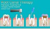 Root Canal Therapy: Painless Treatment at Hungary Dental Implant