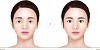 Find Certified Double Eyelid Surgery In Korea