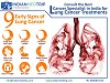 Consult the Best Cancer Specialist in India for Your Lung Cancer Treatments