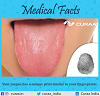 MEDICAL FACT OF THE DAY - Curaa