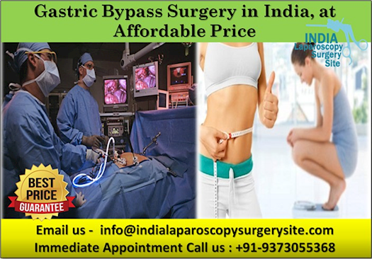 For example: Patent attorney nyc Gastric Bypass Surgery in India, at Affordable Price