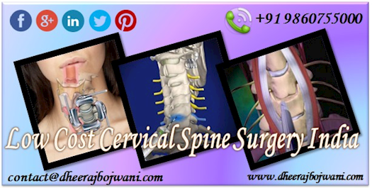 Minimal Cost for Cervical Spine Surgery India for Global Patients