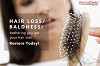 Women Hair Loss Treatment in Delhi