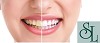 Teeth Whitening in Bloomington MN
