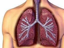 kanker paru-paru
