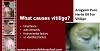 Cure Vitiligo with AROGYAM PURE HERBS KIT FOR VITILIGO