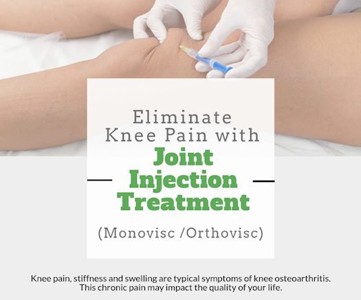 Eliminate Knee Pain with Joint Injection Treatment (Monovisc /Orthovisc)