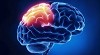 How to remove Brain Tumor