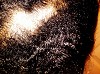 9 Ways to Stop Hair Fall and Regrow Hair Protocol