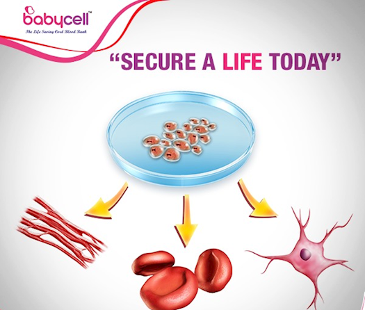 Benefits of banking umbilical cord blood