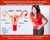 Laparoscopic Uterus Removal Surgery in India: Highly Favoured by Medical Tourists Across the Globe