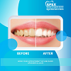 Teeth Cleaning Centre In Dwarka