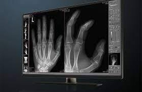Certified Medical Pacs Software Services | QSS Technosoft 