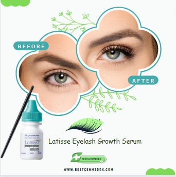 Achieve Luscious Lashes with Latisse Eyelash Growth Serum from BestGenMedRx: