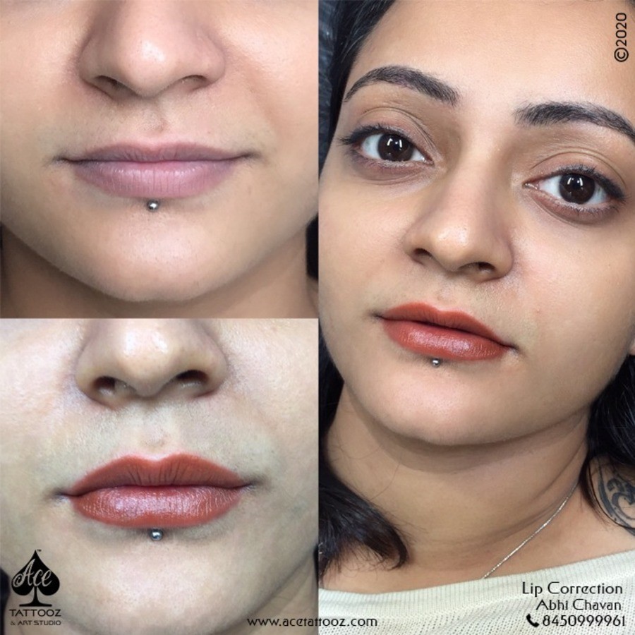 Best Lip Correction Treatment in Mumbai - Ace Tattooz & Art Studio 