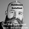 Stop hiding baldness