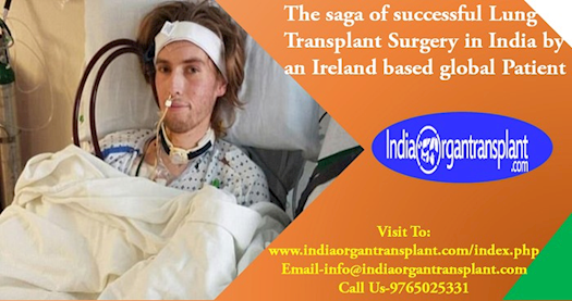 The saga of successful Lung Transplant Surgery in India by an Ireland based global Patient