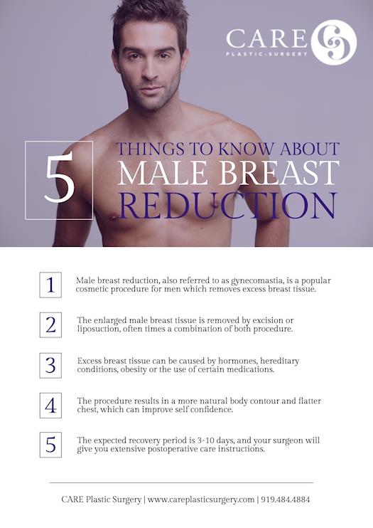 Five Things to Know About Male Breast Reduction