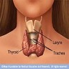 ciri-ciri kelenjar tiroid