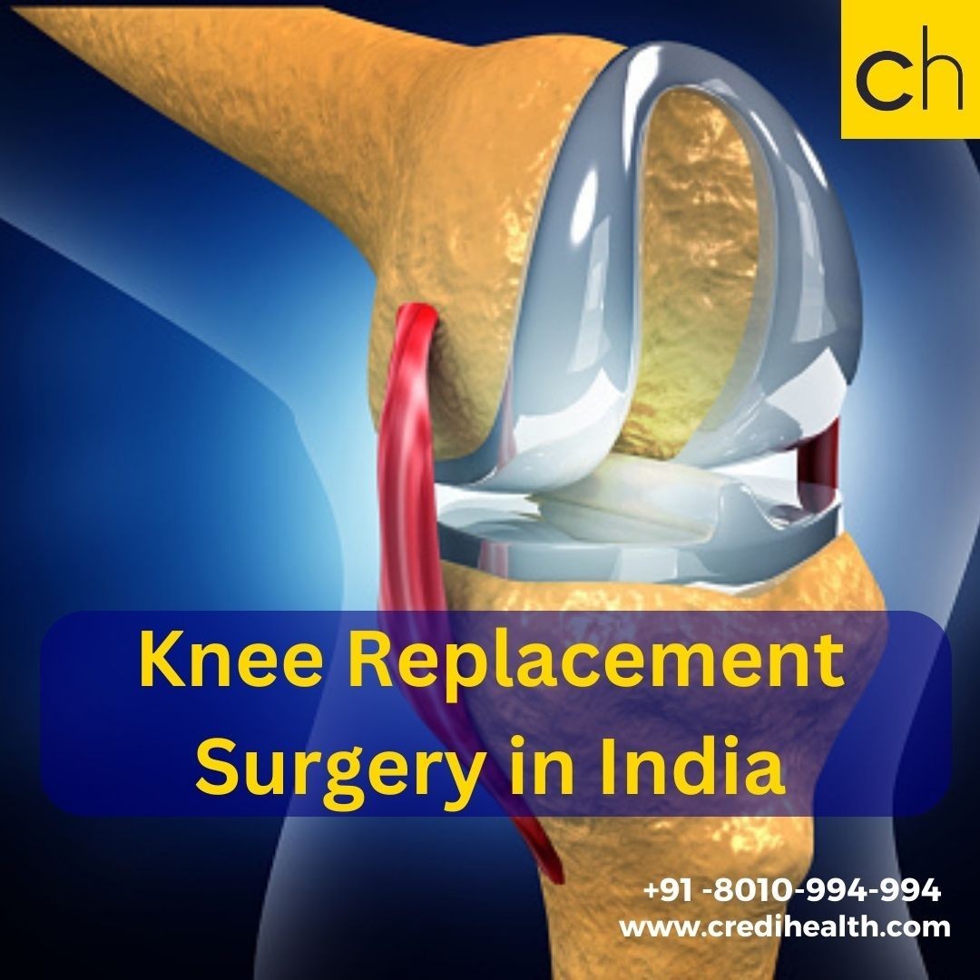 Knee Replacement Surgery in India - Credihealth